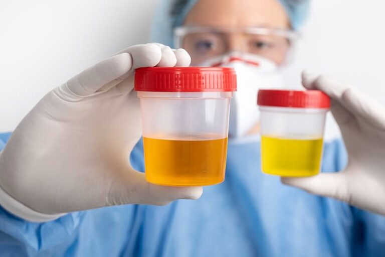 Direct Observation Urine Collection: When And How?