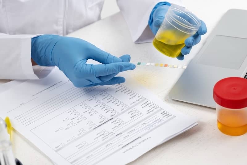 Why Positive Drug Tests Aren’t Always the End of the Road